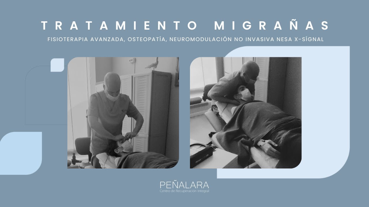TRATAMIENTO MIGRAÑAS