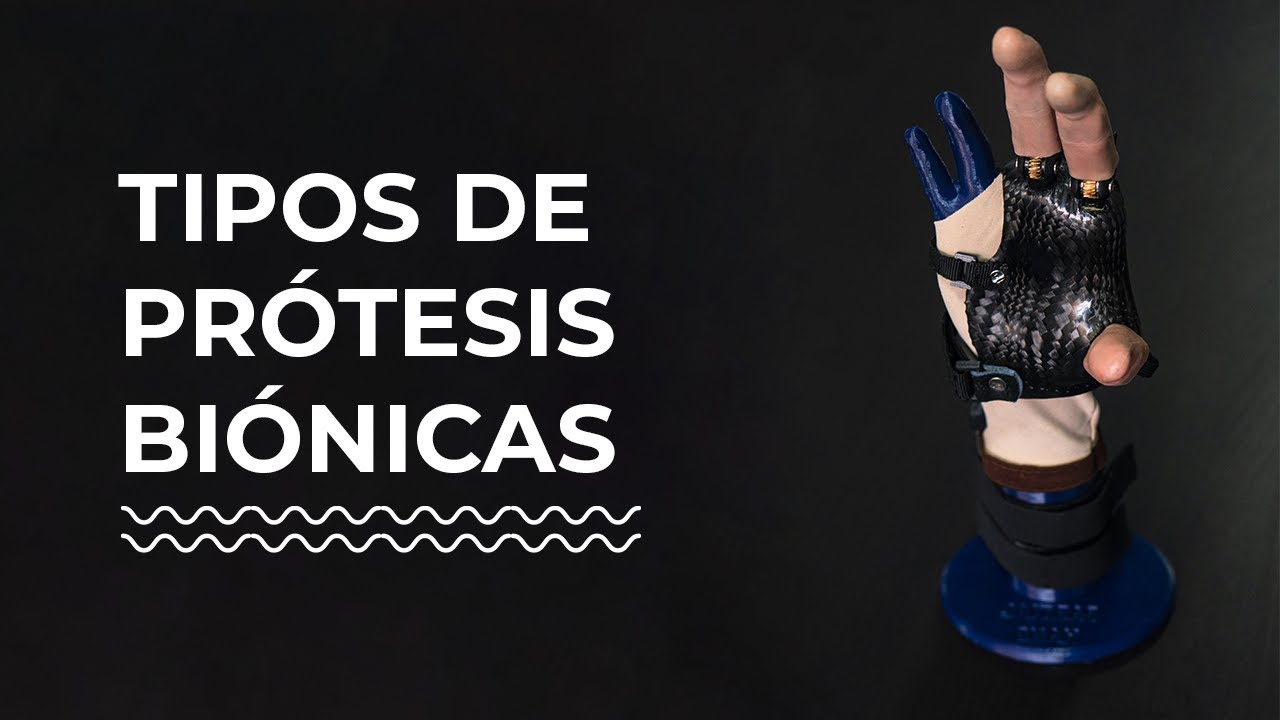 TIPOS DE PRÓTESIS BIÓNICAS 🦾 en Miembros Superiores