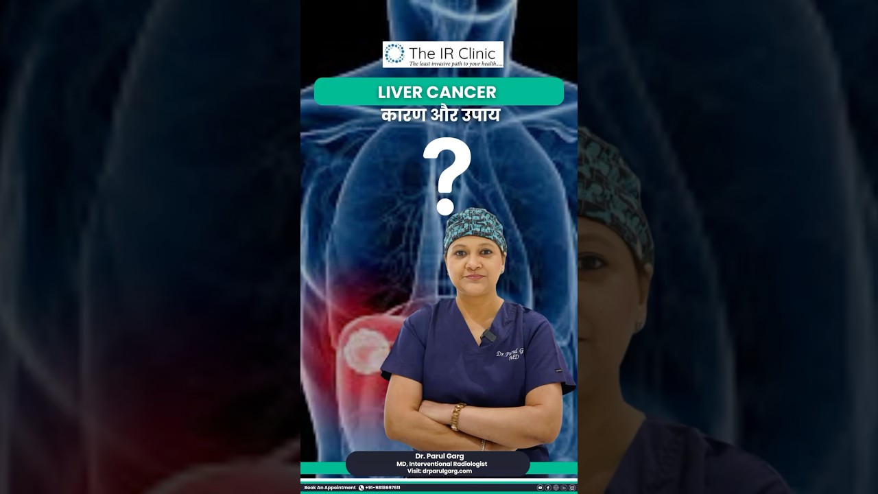 Liver Cancer &ndash; Kya Hain Kaaran Aur Kya Hain Bachav Ke Tarike? | Doctor Explains in Hindi 💚🧬