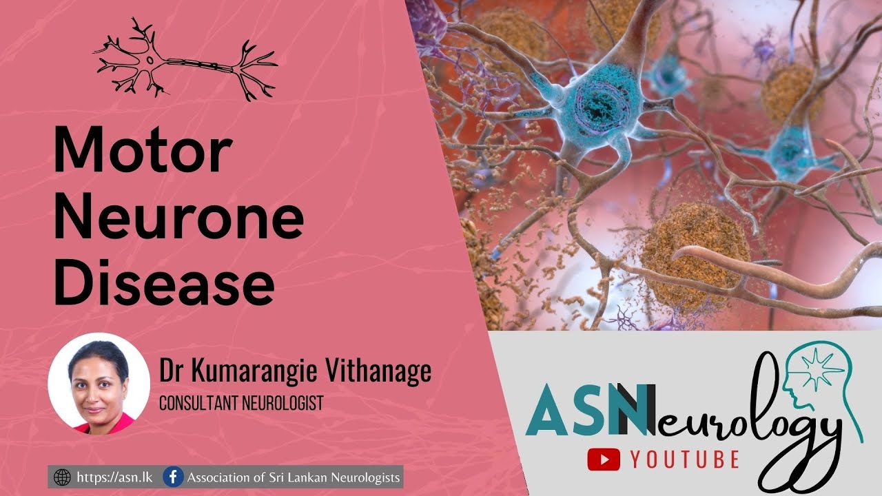 Motor Neurone Disease by Dr Kumarangie Vithanage