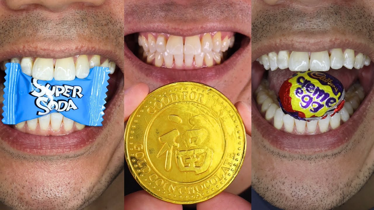Satisfying Chewing ASMR #Compilation #ASMR #DoctorTristanPeh
