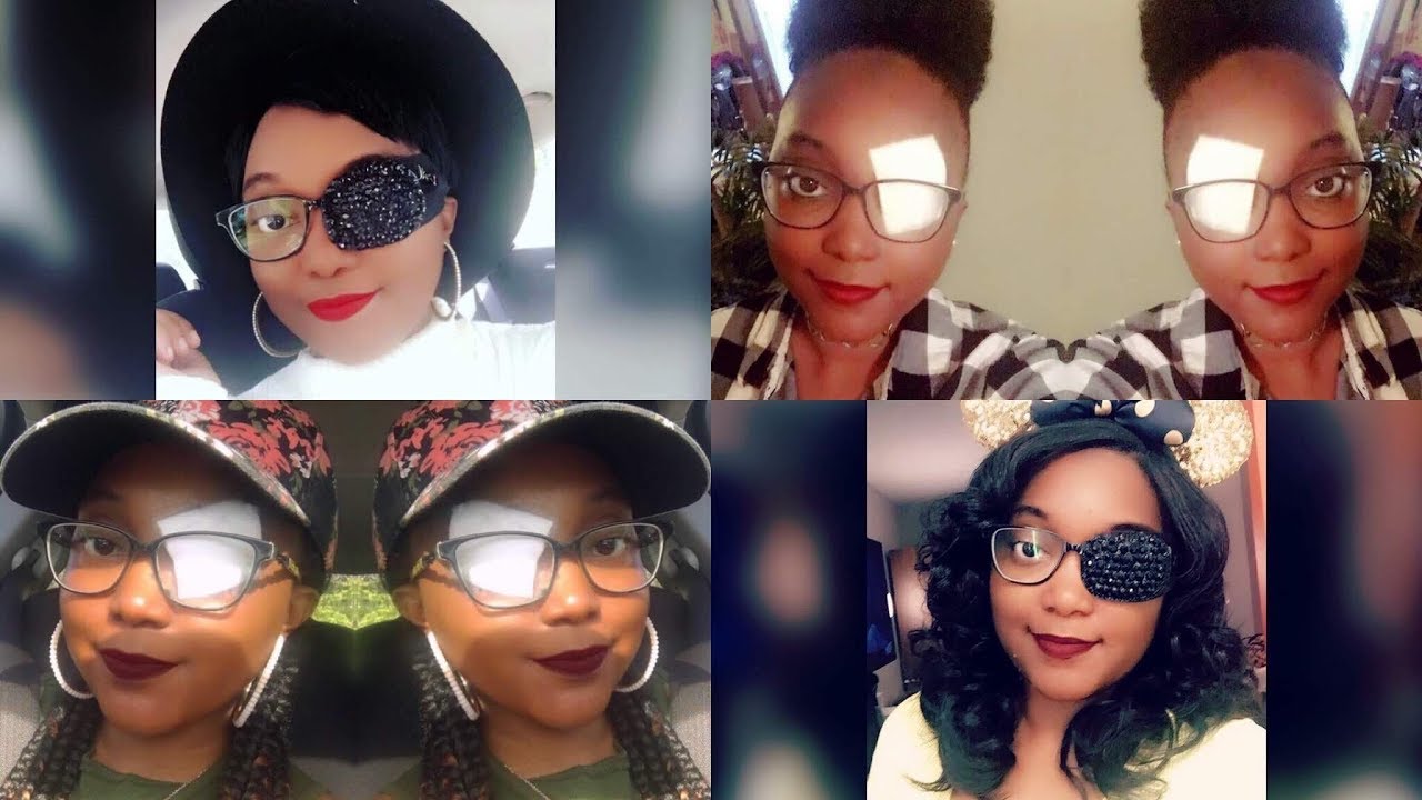 Story Time- Thyroid Eye Disease. The story behind my eyepatch!