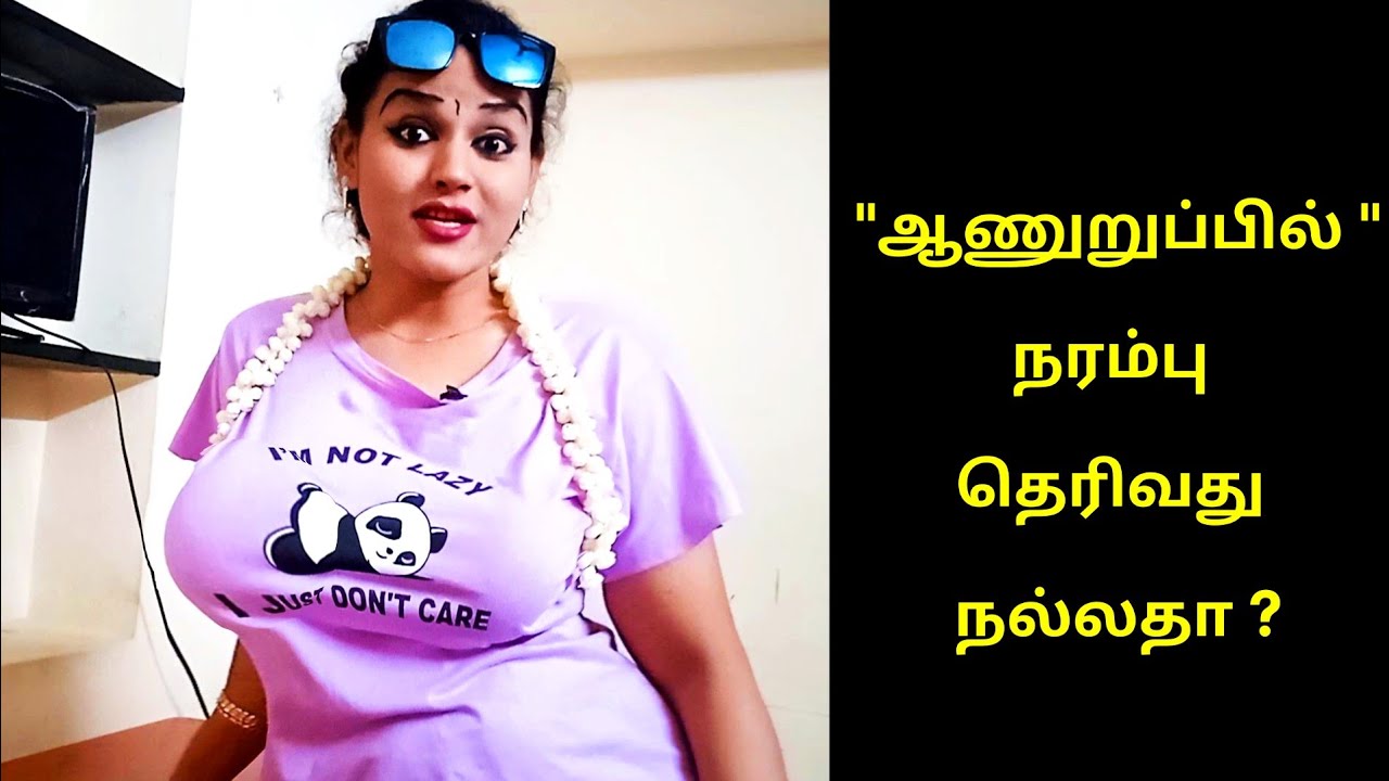 varicose veins remedies