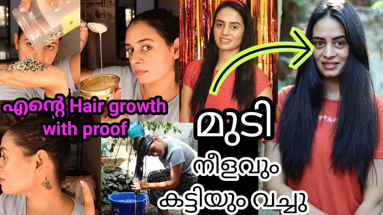 💯Result മുടി വളരാൻ ഞാൻ ചെയ്തു result കണ്ട കാര്യങ്ങൾ ഇത് ചെയ്താൽ ഏത് മുടിയും ഉള്ളോടെ പെട്ടെന്ന് വളരും