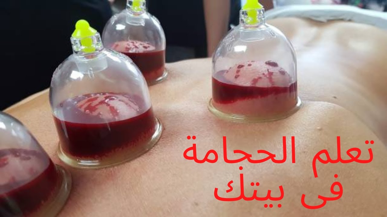 تعليم الحجامة فى بيتك - ندوة الجزائر