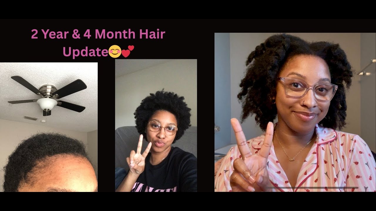 2 Year & 4 Month Hair Update!😊💕 4C Hair/Breakage/Thinning