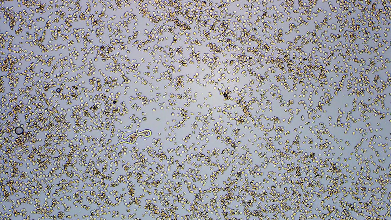 Dirofilaria immitis - microfilaria (100x)