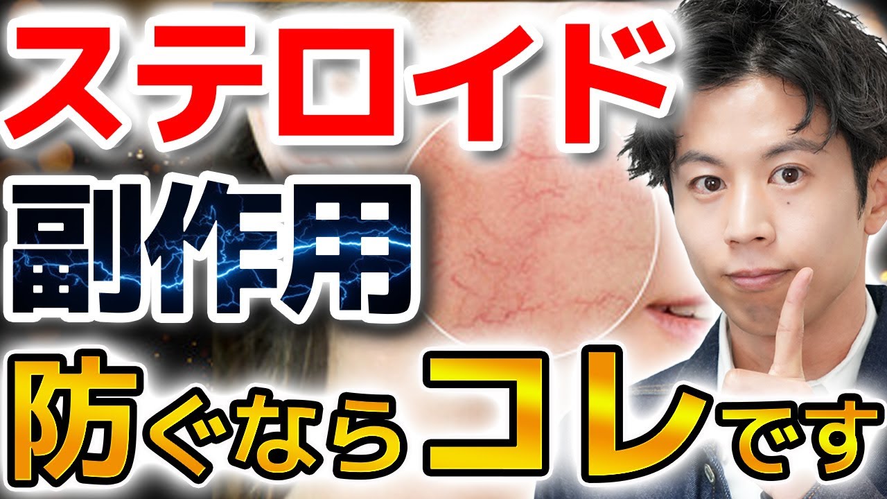 【ステロイド酒さ防げ！】アトピー治療の天敵、ステロイドの副作用と酒さ様皮膚炎を予防するポイントについて