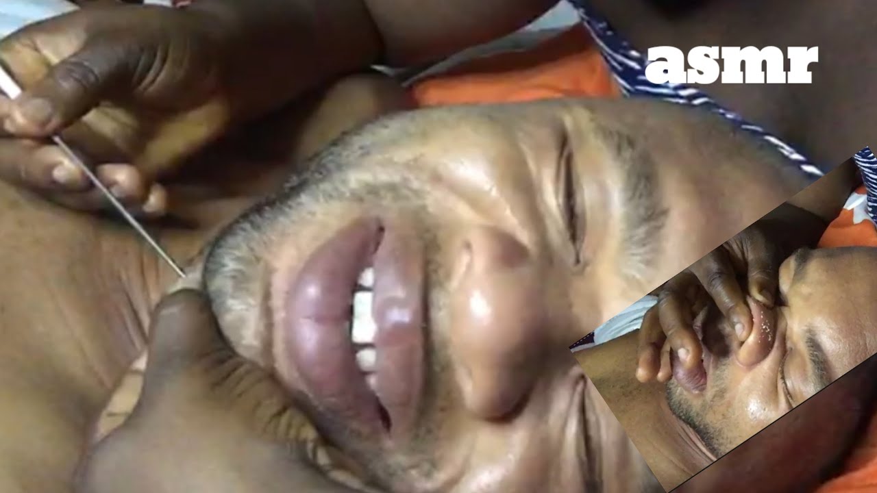 Asmr ✨face treatment on hubby for deep sleep 