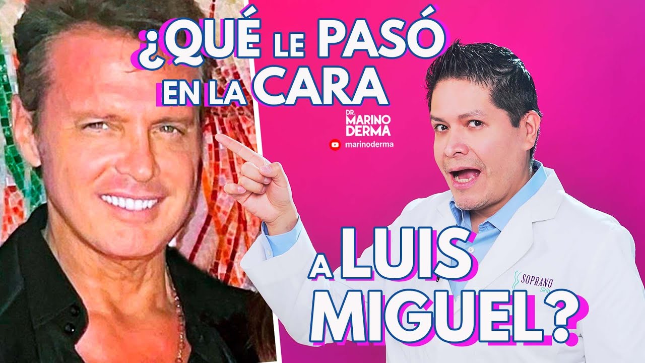 QUE LE PASO EN LA CARA A LUIS MIGUEL