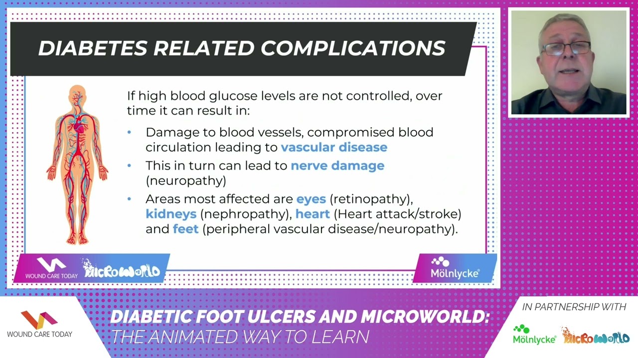 Diabetic foot ulcers and Microworld: The animated way to learn