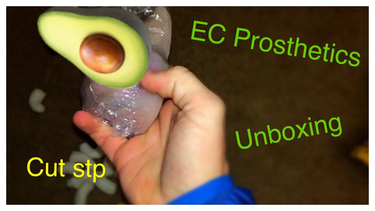 EC Prosthetics STP unboxing **trigger warning**