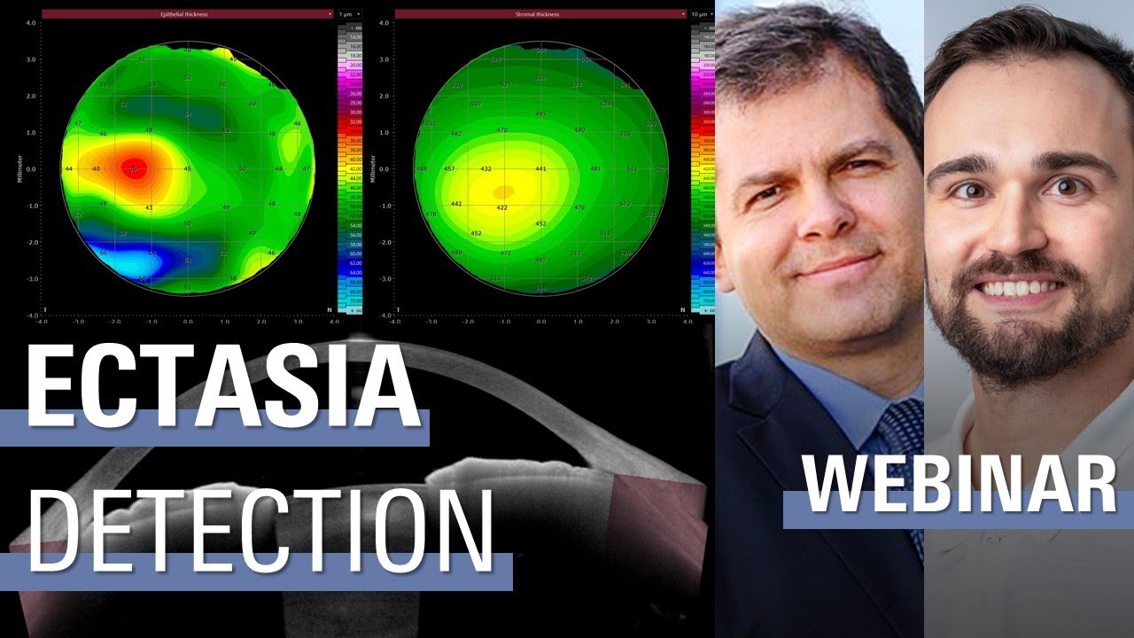 Using Epithelial and Stromal Data for Ectasia Detection &ndash; Renato Ambr&oacute;sio, Robert Herber | ANTERION