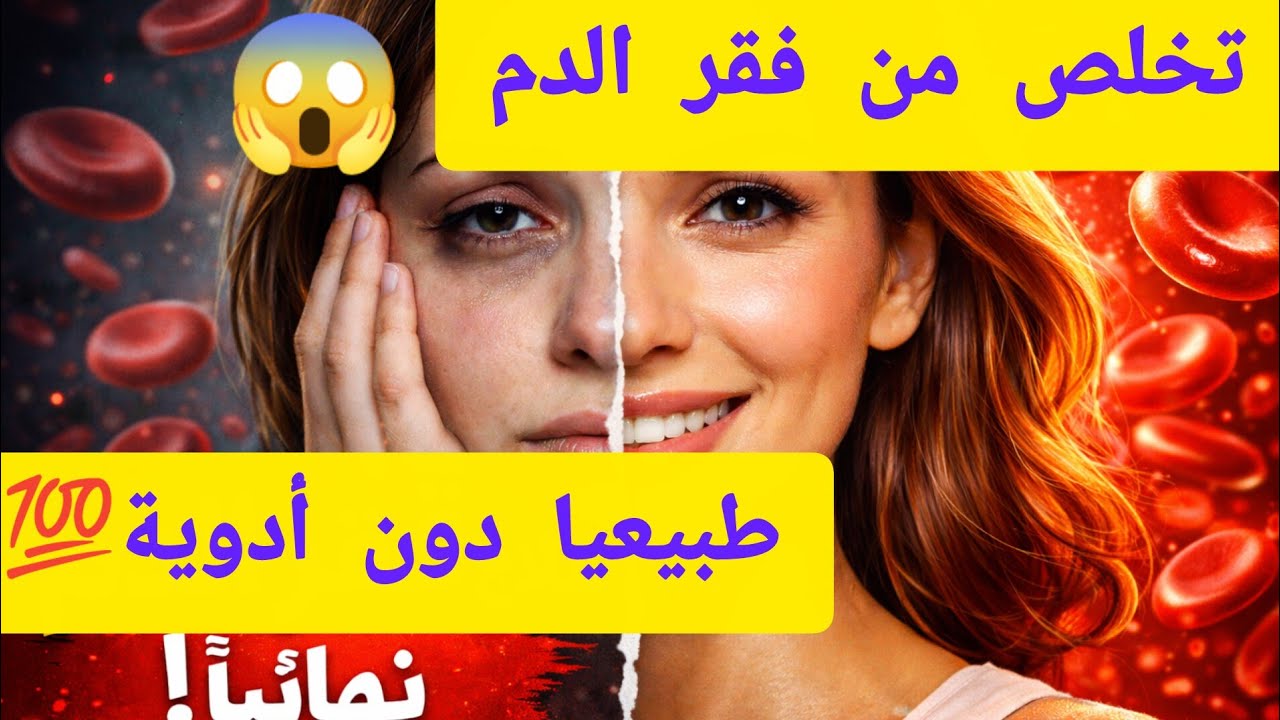 وداعا فقر الدم علاج طبيعي جبار 💪 لفقر الدم 😱