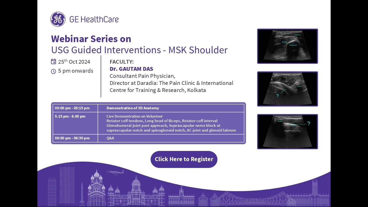 3D Anatomy & Sonoanatomy of Shoulder: Essential Structures for Pain Physicians 🎥🔍