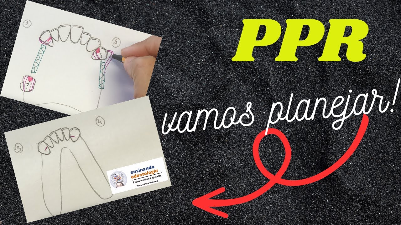PLANEJAMENTO PPR SUPERIOR E INFERIOR