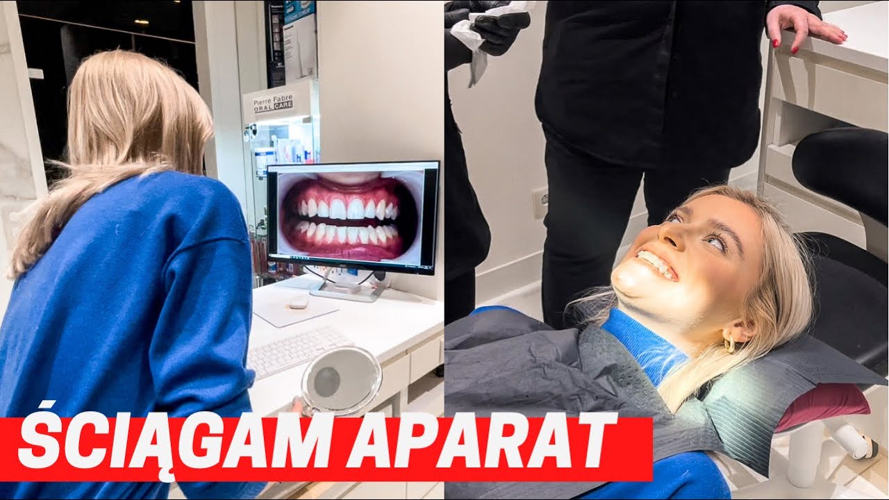 Jak wygląda demontaż aparatu ortodontycznego?😳😱| 2022