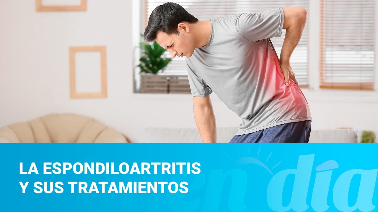 La espondiloartritis y sus tratamientos