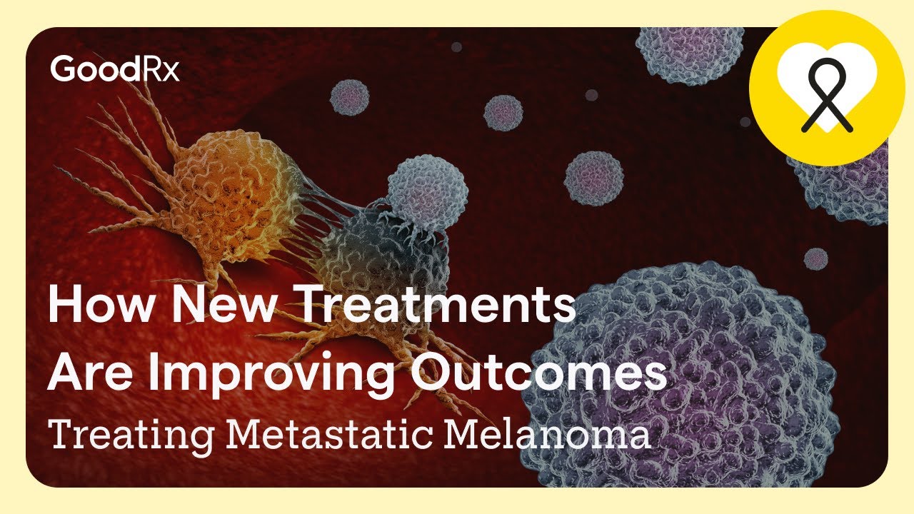 Metastatic Melanoma Treatment: What You Need to Know | GoodRx