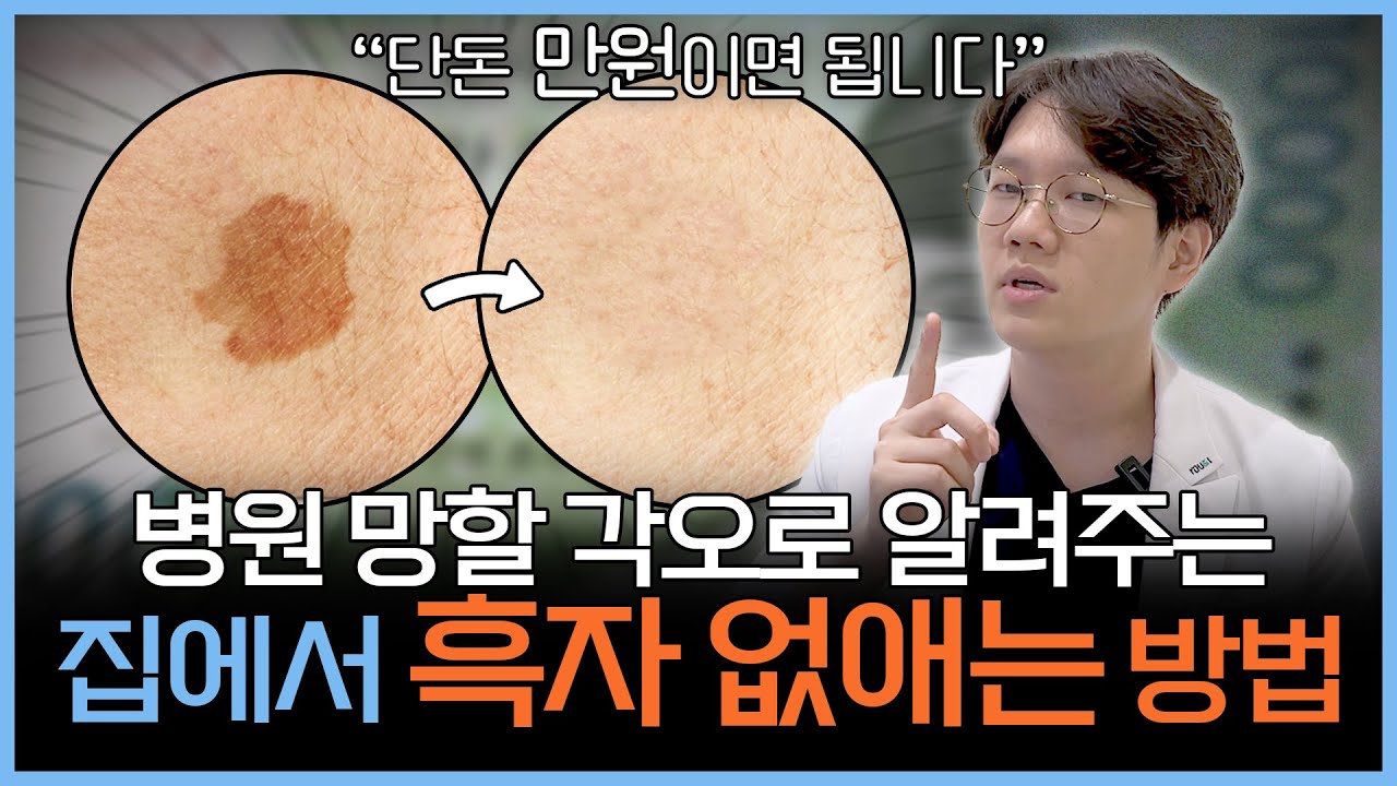 단돈 만원으로 흑자 집에서 손쉽게 없애는 방법! | 피부과 안가고 흑자 없애는 방법