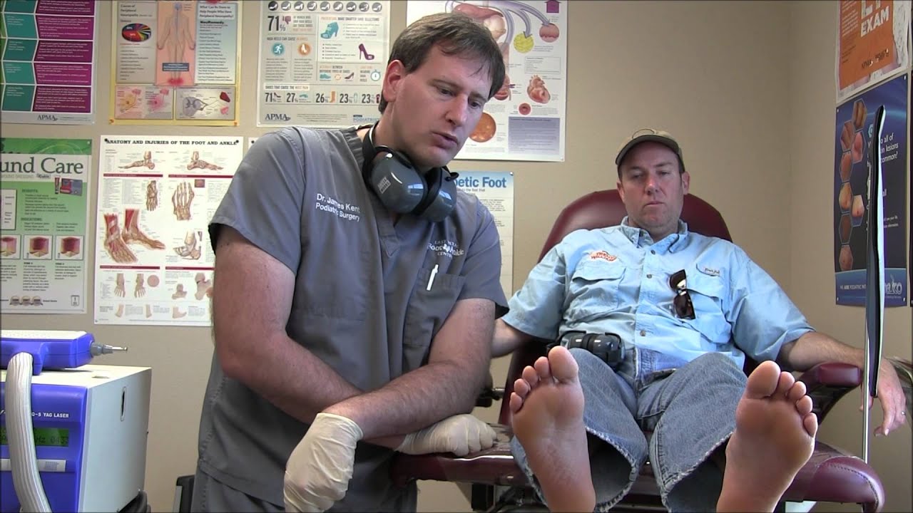 Fungal Nail Laser Treatment