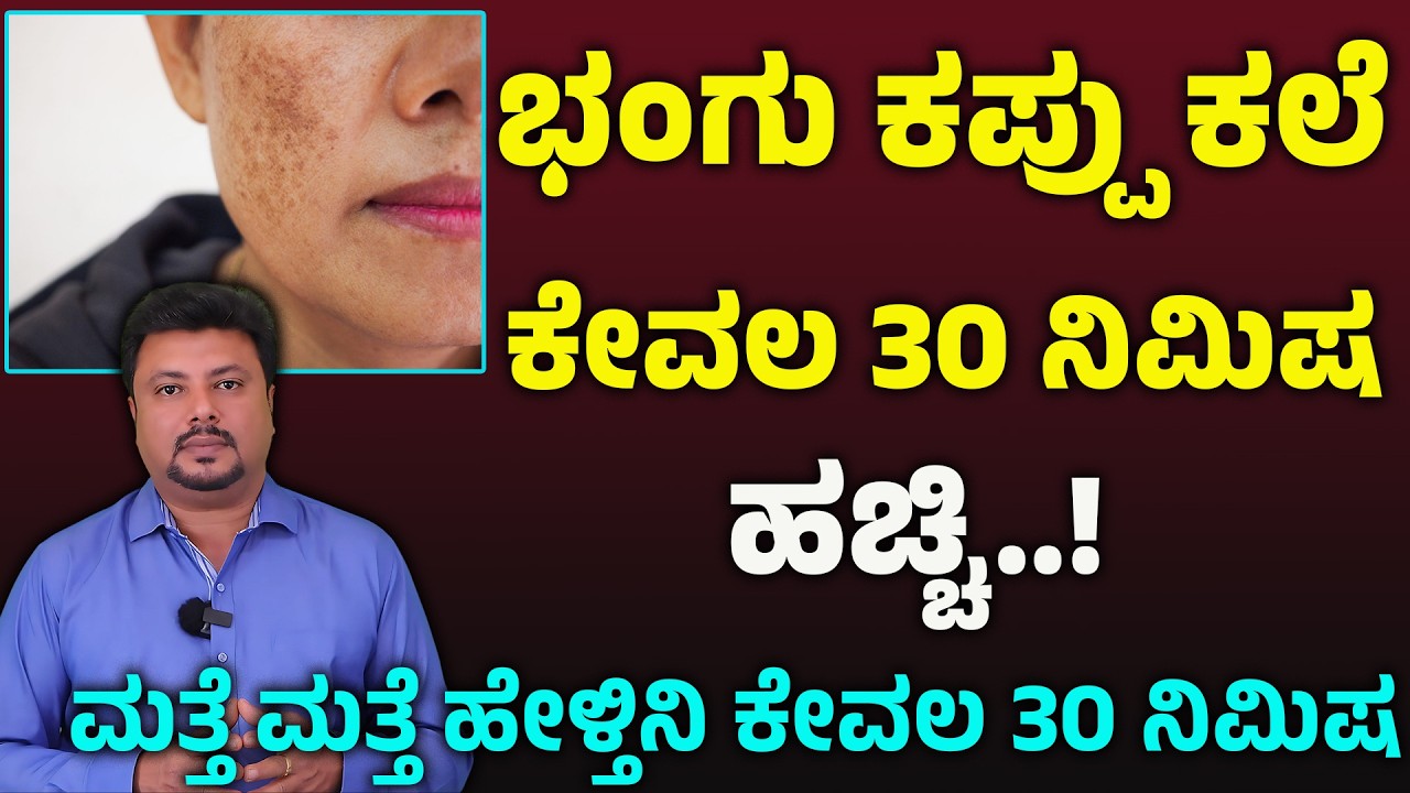 ಮುಖದಲ್ಲಿ ಭಂಗು ಬರಲಿಕ್ಕೆ ಇವೆ ಕಾರಣಗಳು | Bhangu Nivarane Mane Maddu | Pigmentation In Kannada