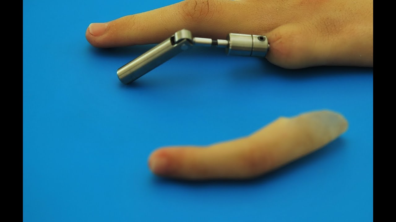 Prótesis con mecanismo osseo integrado, (finger prosthesis), No  15