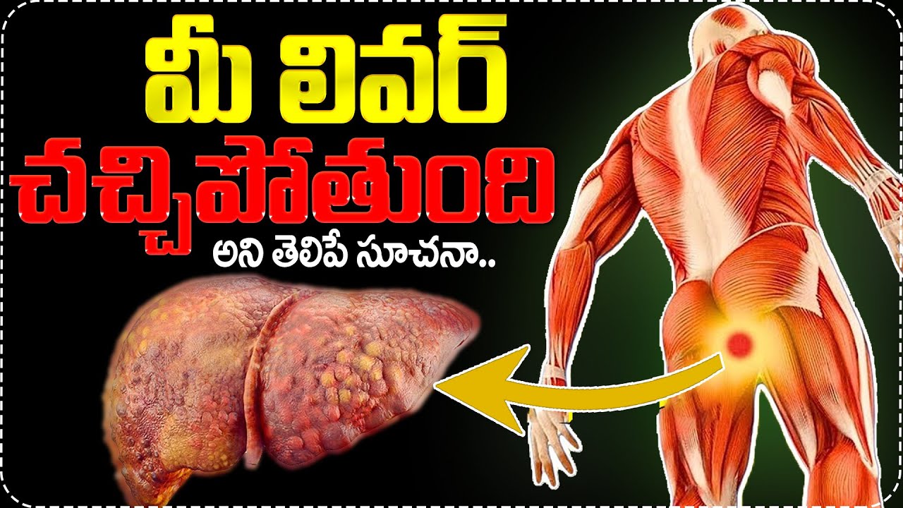 10 Symptoms of Liver Problem | liver damage Sign || Dr Nageshwar Reddy || Anchor Swapna || SumanTV