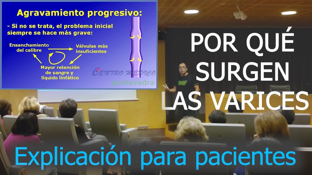 Conferencia sobre varices e insuficiencia venosa periférica
