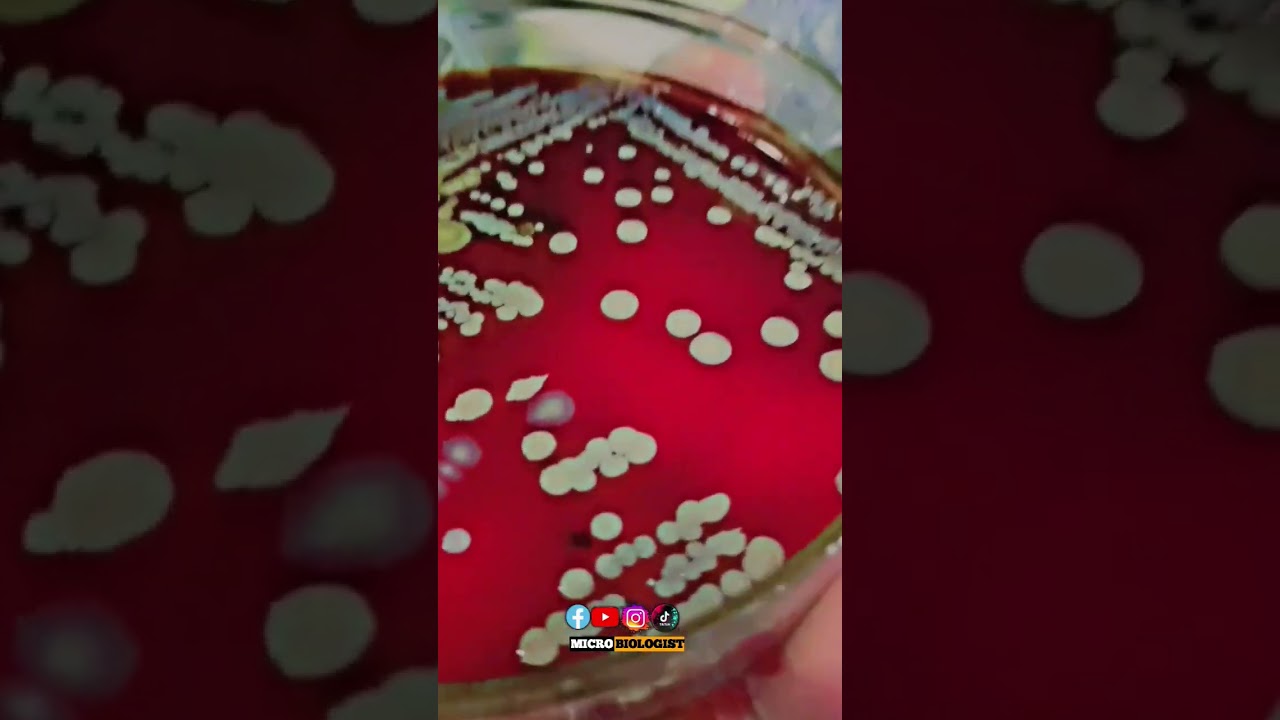 S.Aureus || Methicillin Resistant Staphylococcus aureus treatment || MICROBIOLOGIST