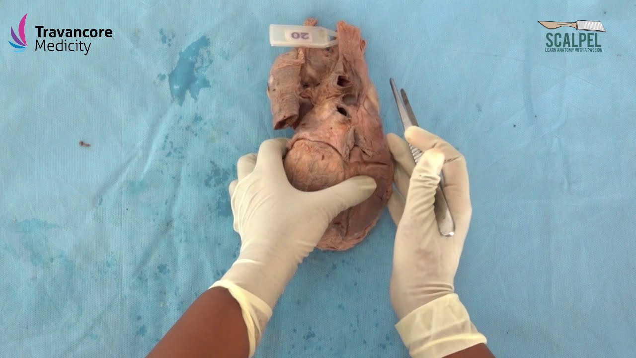 Heart-External Features