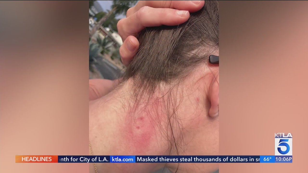Serial 'projectile' sniper in Ventura targeting pedestrians