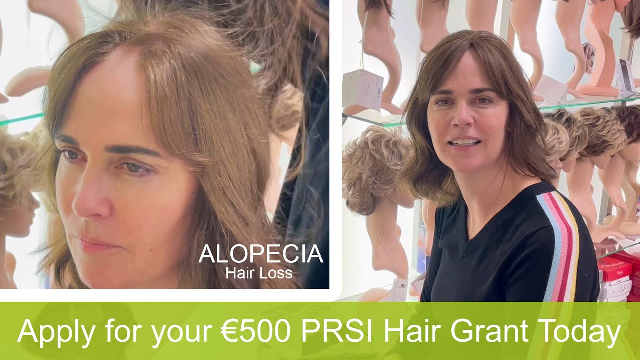 Alopecia Client from USA Travels for our Famous Hair Toppers