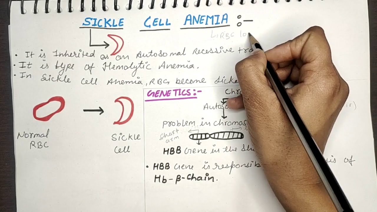SICKLE CELL ANEMIA WITH SICKLING TEST