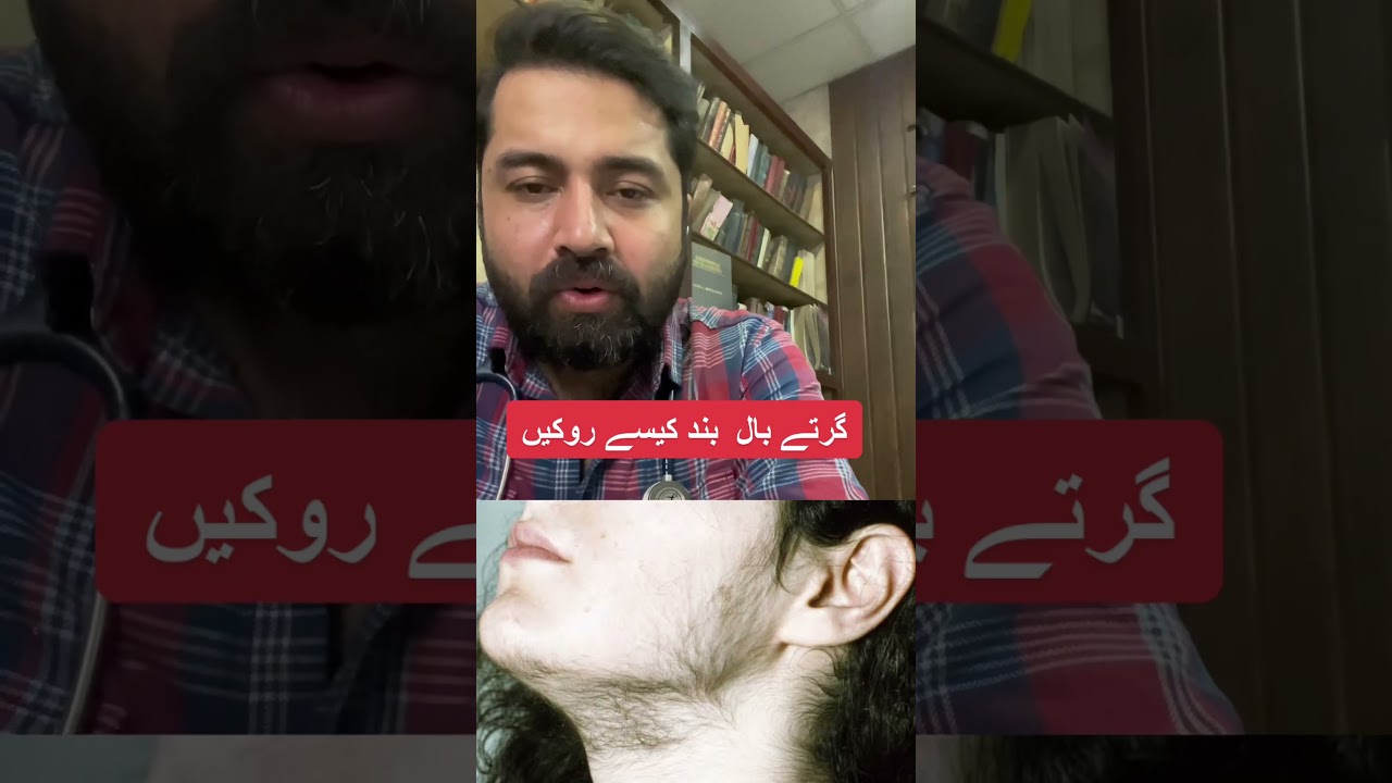 Stop hair fall guaranteed with Minoxidil, the magic hairspray story 