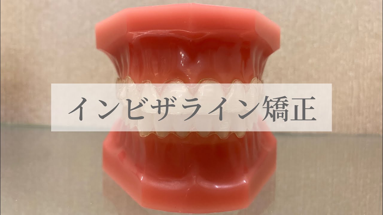 【インビザライン治療】使い方、浮きについて🦷治療を始める前にぜひ見て下さい😊