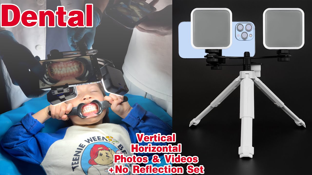Advanced Dental Photography with a Smartphone | MK-19 White