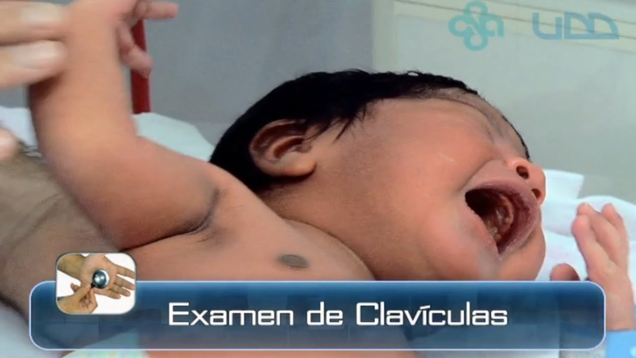 🌟EXAMEN DE LAS CLAVÍCULAS DEL RECIÉN NACIDO🌟