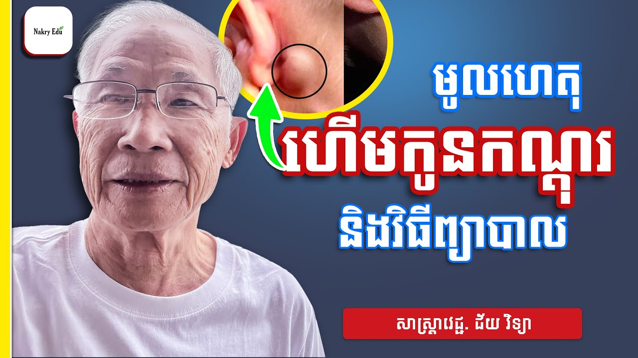 យល់ដឹងពីកូនកណ្ដុរក្នុងរាង្គកាយ - មូលហេតុ ហើមកូនកណ្ដុរ - Nakry Edu