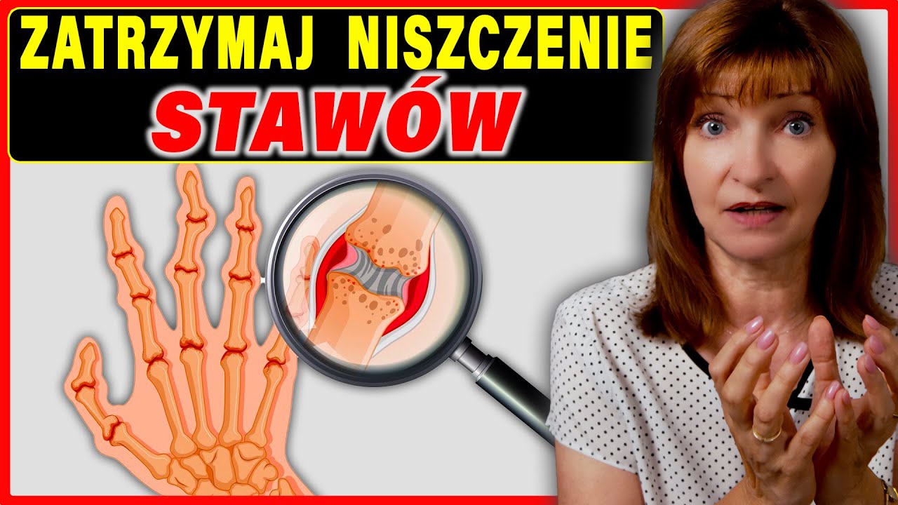 Artretyzm &ndash; 2 naturalne kuracje, kt&oacute;re naprawdę działają! Zapomnij o b&oacute;lu i sztywności