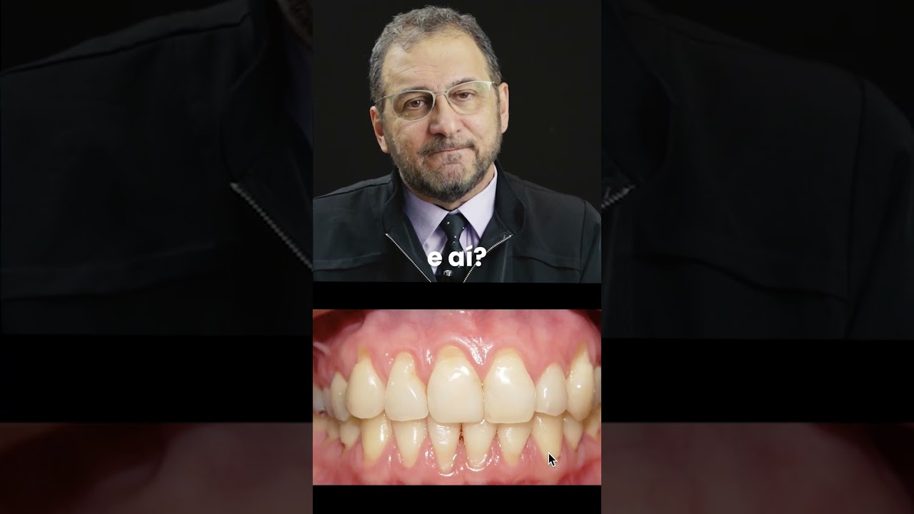 Pesso errado nos dentes anteriores, interfer&ecirc;ncia oclusal