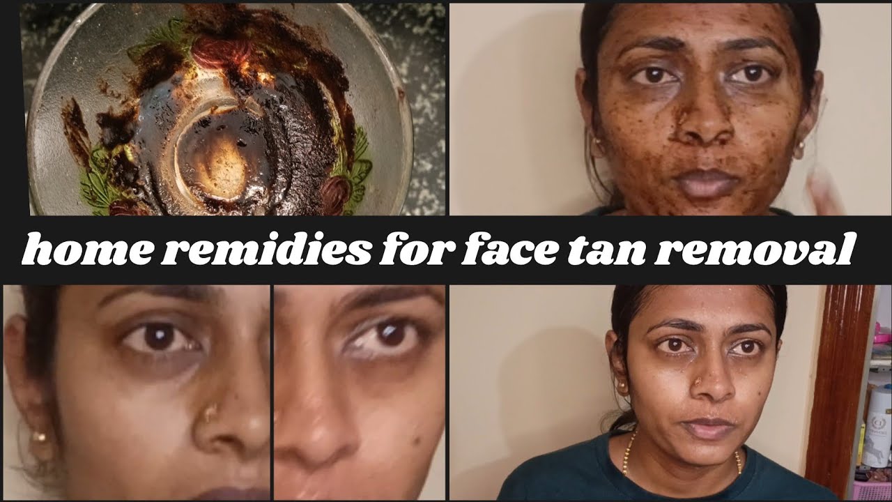 VLOG || 💥🤷‍♀️home remidies for tan removal || ಟ್ಯಾನ್ ಗೆ ಮನೆ ಮದ್ದುಗಳು @yudvigowda 