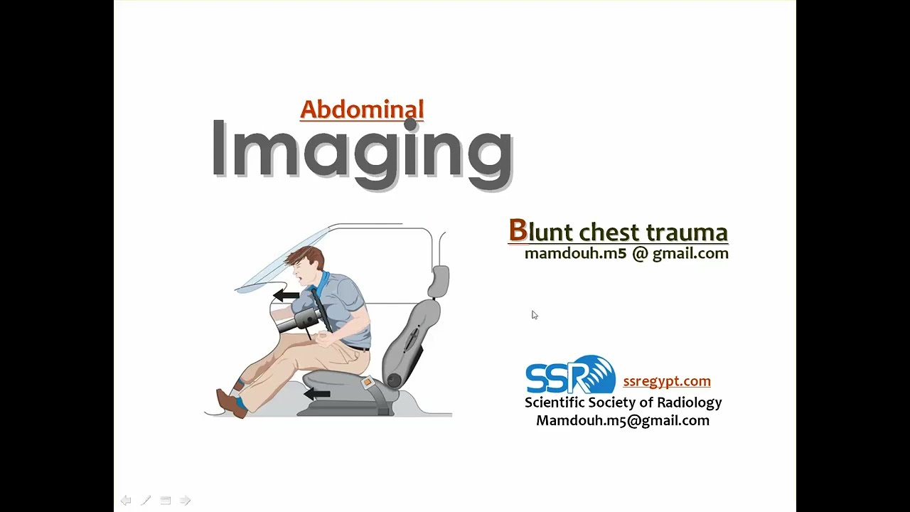 3  Chest trauma imaging  TEC  Prof  Mamdouh Mahfouz