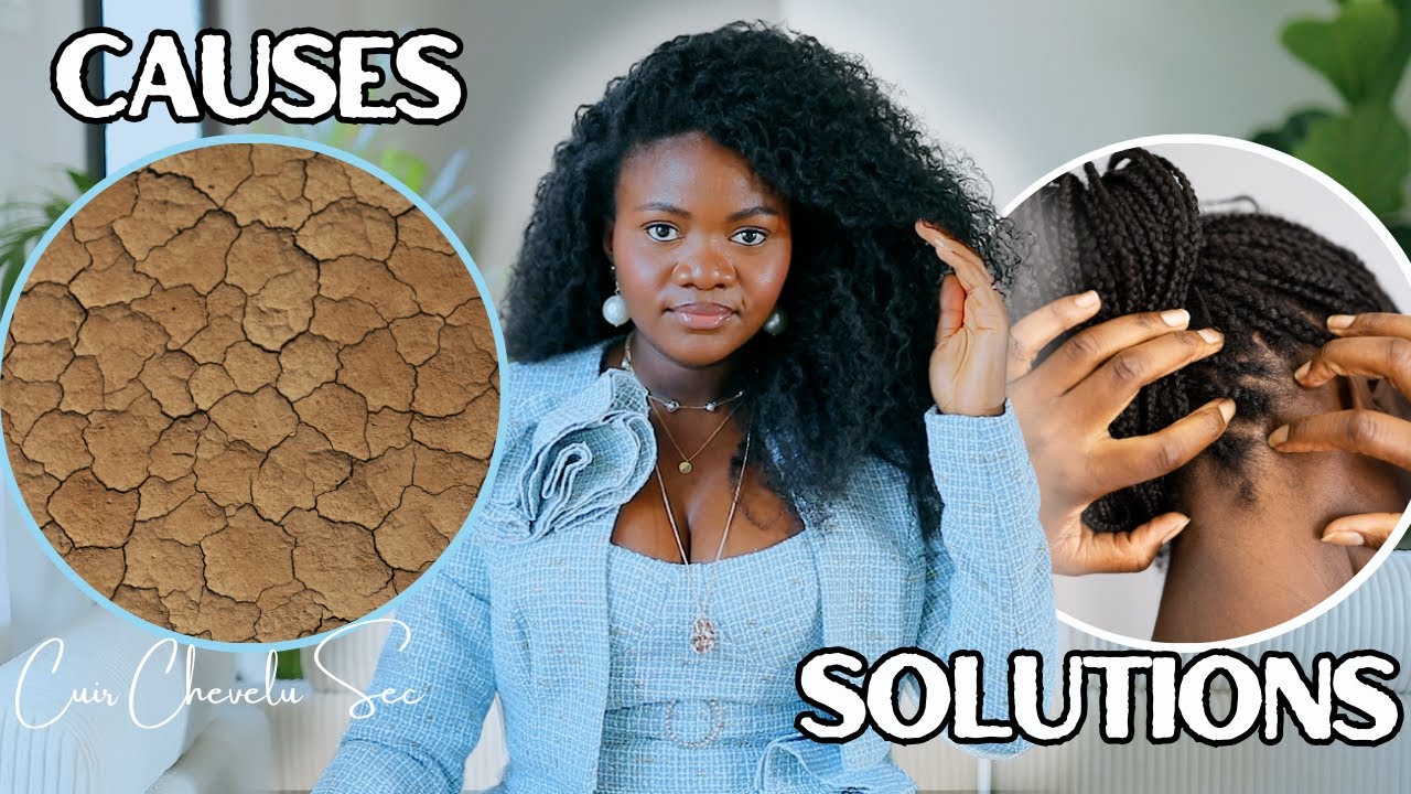 CUIR CHEVELU SEC || CAUSES ET SOLUTIONS POUR CHEVEUX AFRO CRÉPUS