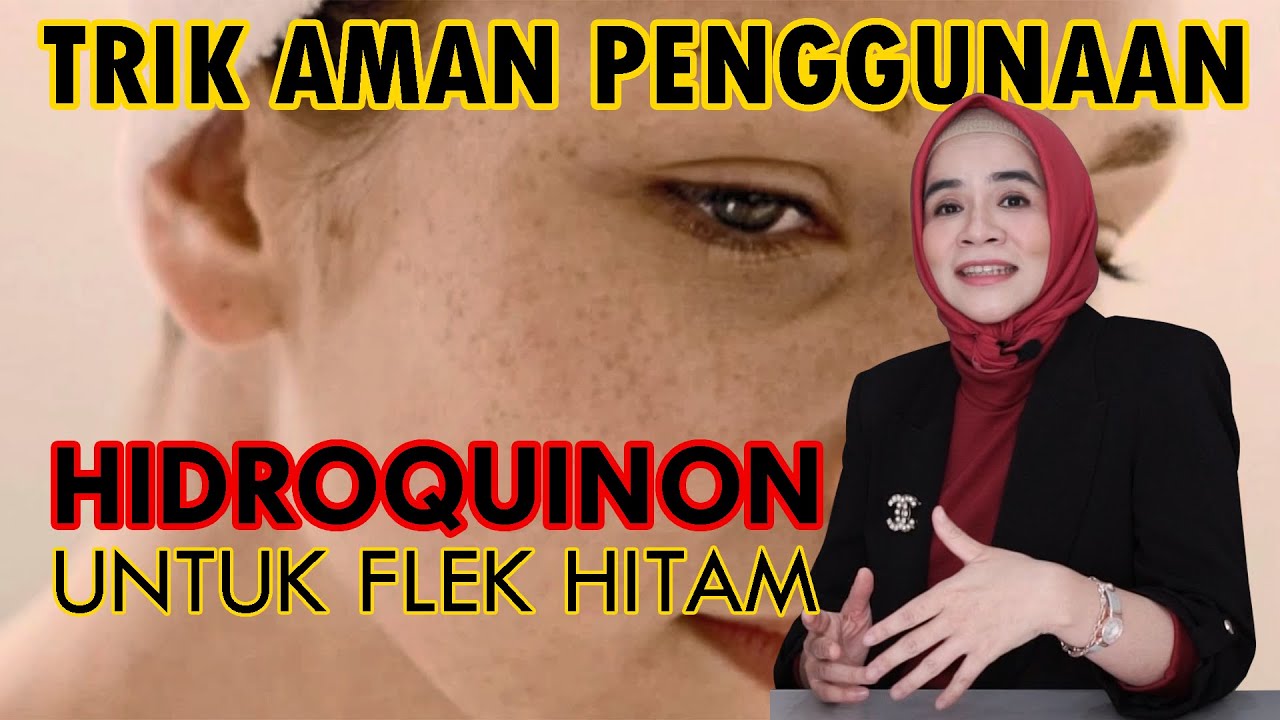 HIDROQUINON UNTUK FLEK HITAM, AMANKAH???