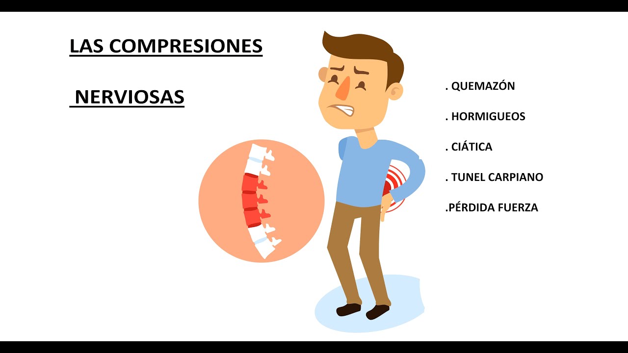 PINZAMIENTOS Y  COMPRESIONES NERVIOSAS  ¿QUÉ DEBO HACER?¿COMO SE SOLUCIONA?