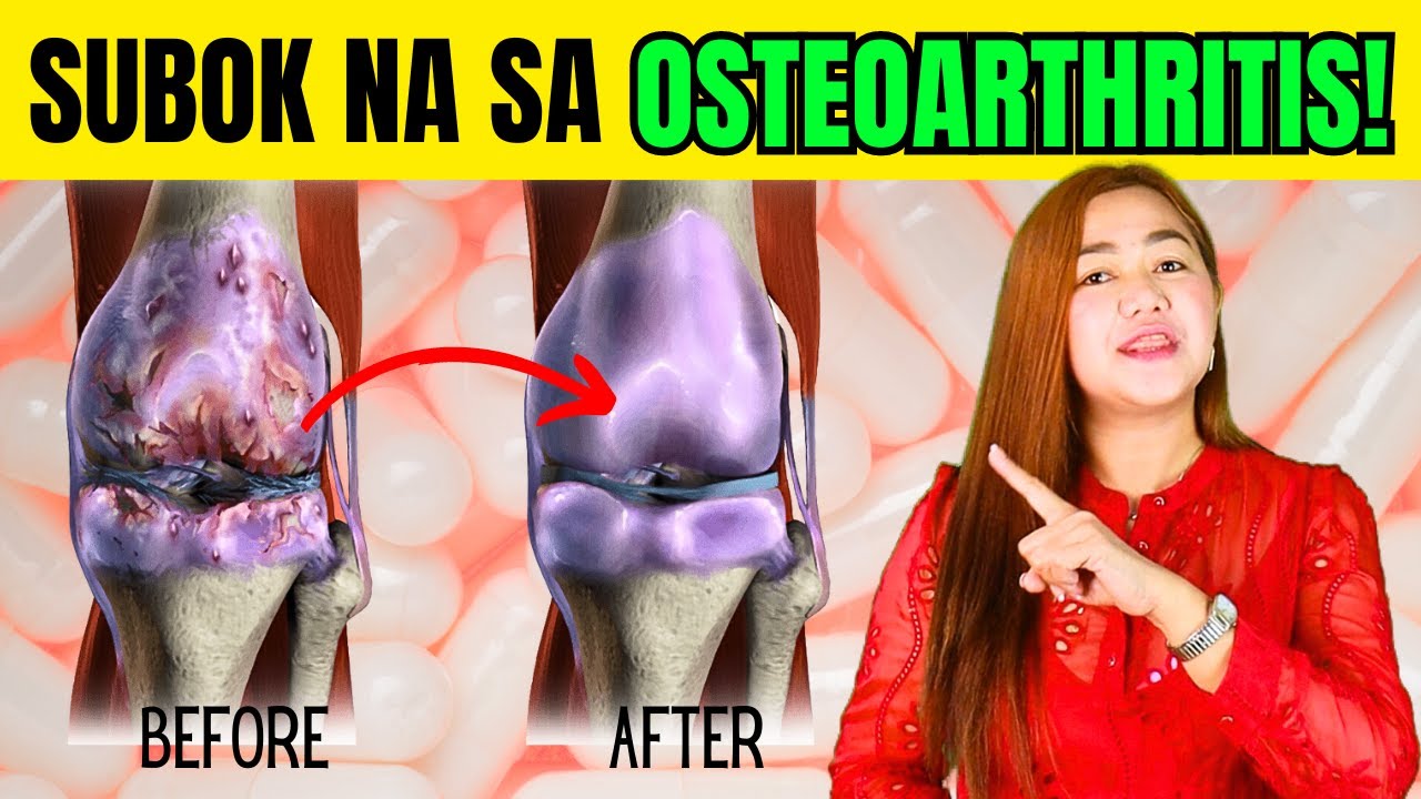 KAILANGAN Mo Ito Para Sa Osteoarthritis (Wonder Cure)! | Doc Cherry