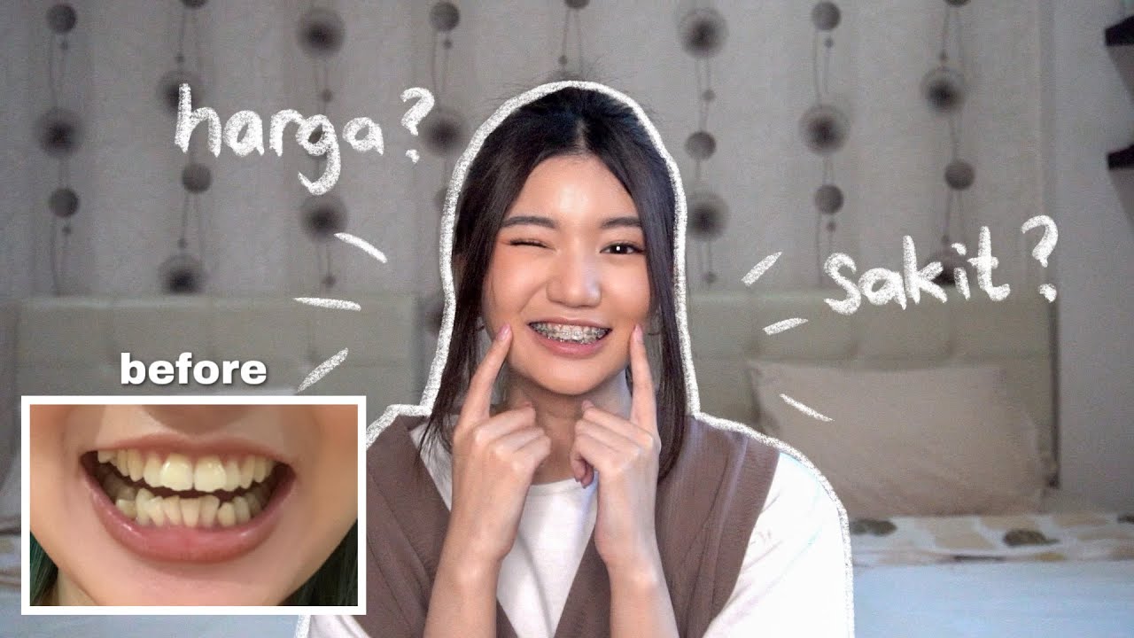 PENGALAMAN PAKAI BEHEL | SAKIT GA?