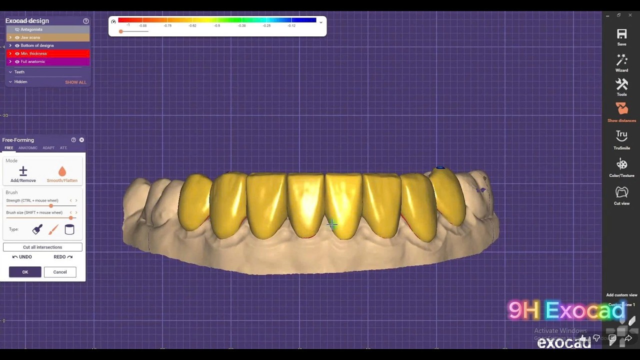 Exocad design