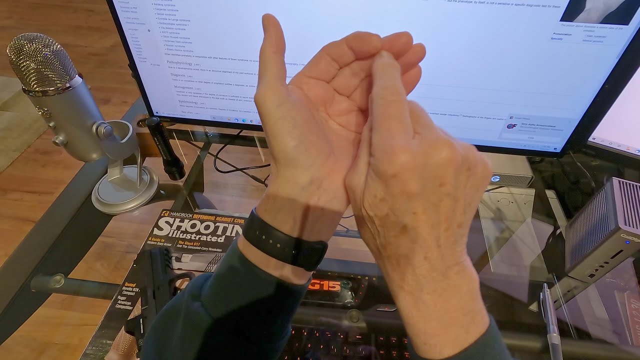 Trigger Bite (sting, slap, pinch) Explained and Solved